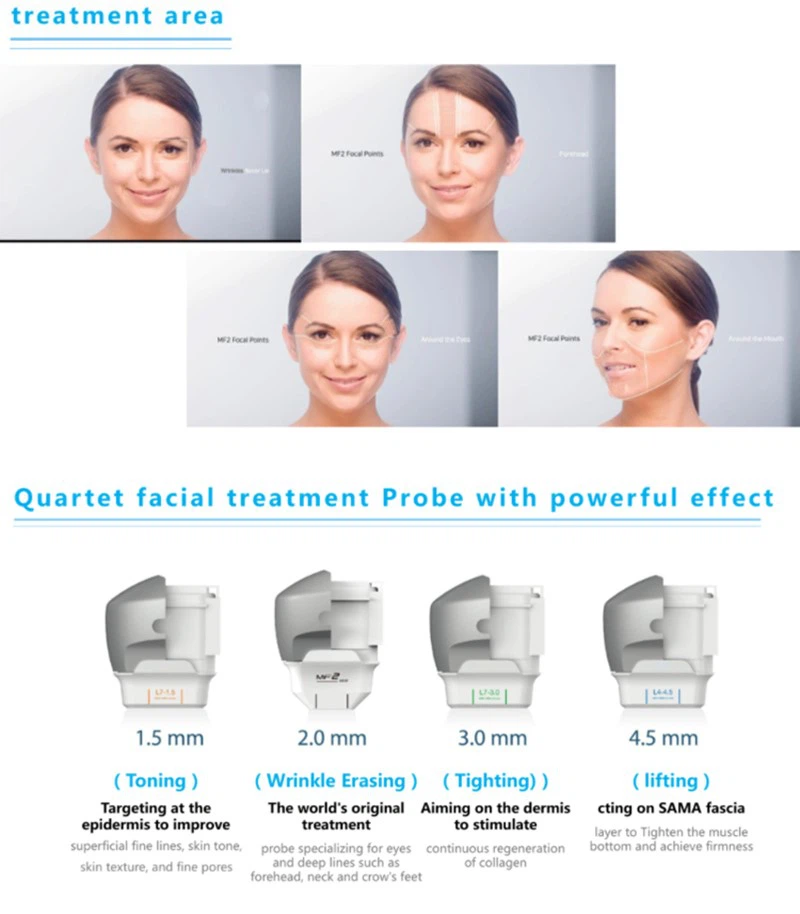 7D-Hifu-treatment 7D-Hifu-treatment