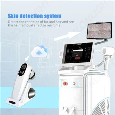 Yapay Zeka Sistemli Lazer Epilasyon Makinesi
